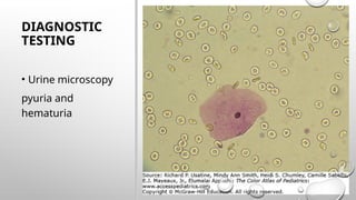 Urinary Tract Infections.. A ppt on introduction to UTIs | PPTX