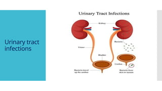 Urinary tract
infections
 
