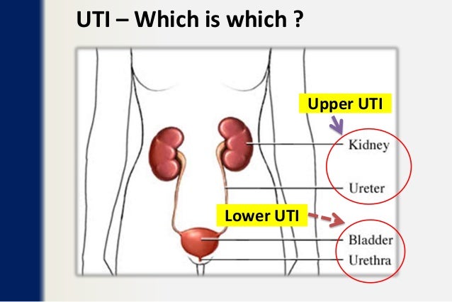 Uraniry tract infection