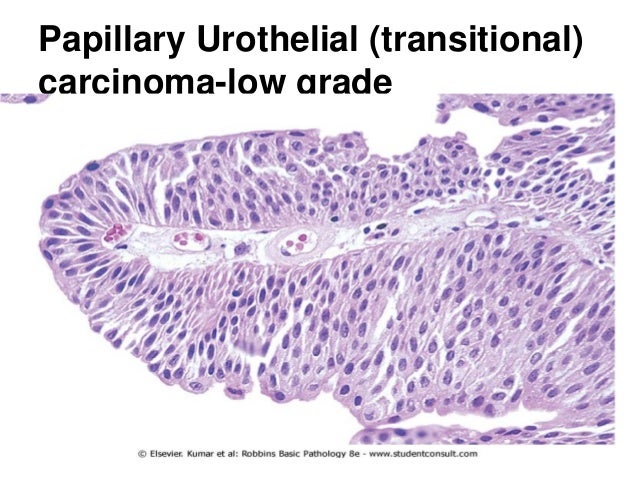 Urinary tract pathology lab