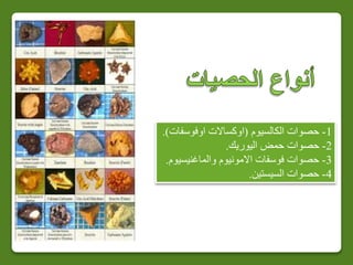 1-‫ح‬‫صوات‬‫ال‬‫كالسيوم‬(‫اوفوسف‬ ‫اوكساالت‬‫ات‬.)
2-‫اليوريك‬ ‫حمض‬ ‫حصوات‬.
3-‫والماغنيسيوم‬ ‫االمونيوم‬ ‫فوسفات‬ ‫حصوات‬.
4-‫السيستين‬ ‫حصوات‬.
 