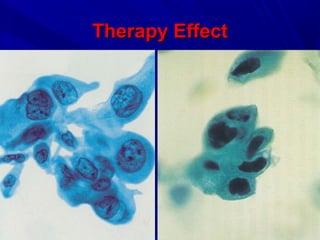 Therapy EffectTherapy Effect
 