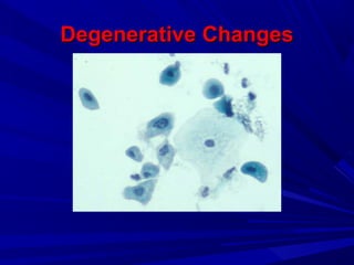 Degenerative ChangesDegenerative Changes
 