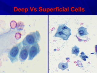 Deep Vs Superficial CellsDeep Vs Superficial Cells
 
