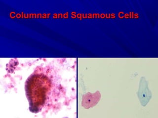 Columnar and Squamous CellsColumnar and Squamous Cells
 