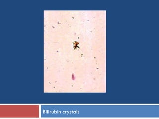 Strasinger Stool Colors Urine-sediments- URINALYSIS STRASINGER.ppt