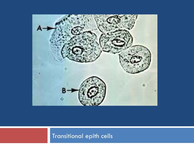 Strasinger Stool Color Urine-sediments- URINALYSIS STRASINGER.ppt