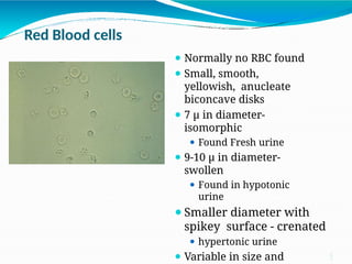 Swallloen Rbc urine 1.pptx RTS455Y5S656XXTYS56SE4EEDT FFHR6 | PPTX