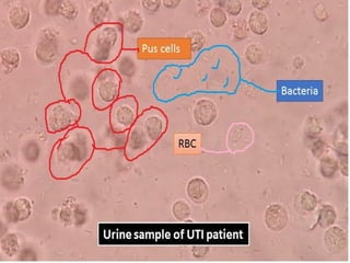 urine alaysis final biochemistry presentation