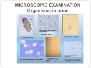 urine alaysis final biochemistry presentation