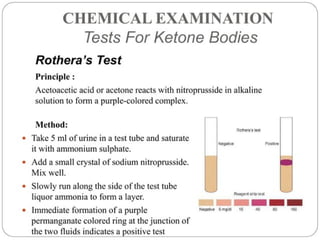 urine alaysis final biochemistry presentation