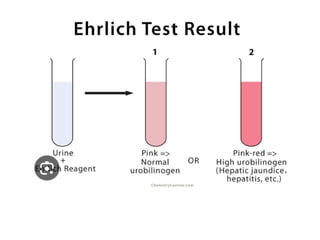 urine alaysis final biochemistry presentation