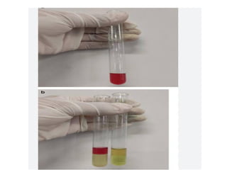 urine alaysis final biochemistry presentation