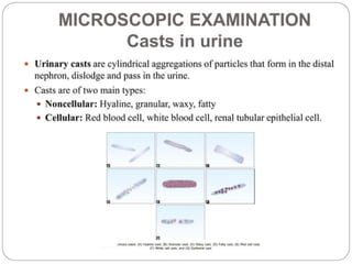 urine alaysis final biochemistry presentation