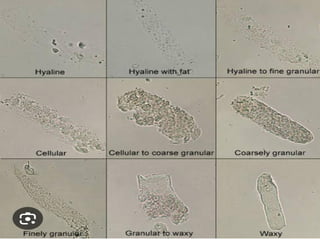 urine alaysis final biochemistry presentation