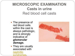 urine alaysis final biochemistry presentation