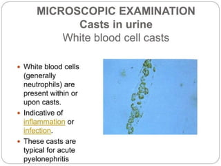 urine alaysis final biochemistry presentation