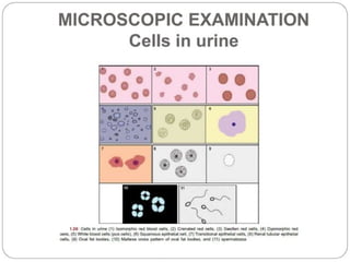 urine alaysis final biochemistry presentation