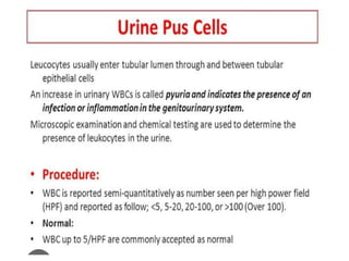 urine alaysis final biochemistry presentation