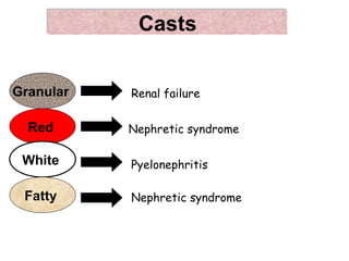 Casts


Granular   Renal failure

  Red      Nephretic syndrome

 White     Pyelonephritis

 Fatty     Nephretic syndrome
 