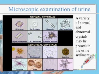 Microscopic examination of urine
Avariety
of normal
and
abnormal
crystals
may be
present in
the urine
sediment
 