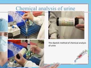 Chemical analysis of urine
The dipstick method of chemical analysis
of urine
 