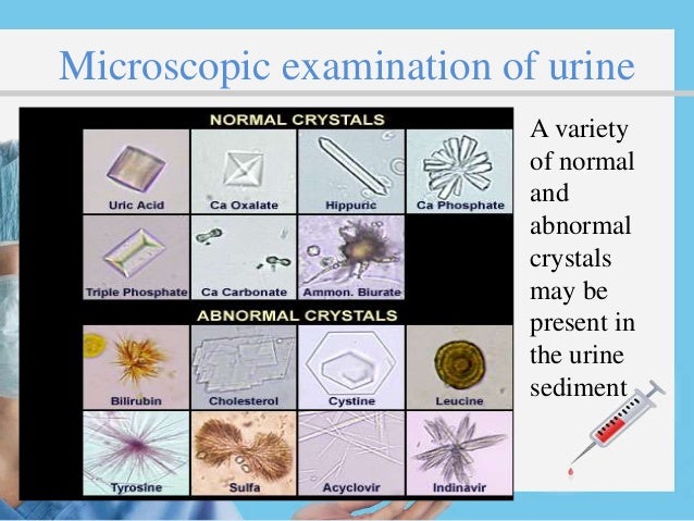 Urine Crystals Chart