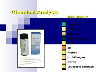Chemical AnalysisChemical Analysis
Urine DipstickUrine Dipstick
Glucose
Bilirubin
Ketones
Specific Gravity
Blood
pH
Protein
Urobilinogen
Nitrite
Leukocyte Esterase
 