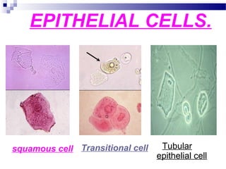 EPITHELIAL CELLS.
squamous cell Transitional cell Tubular
epithelial cell
 
