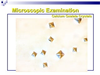 Microscopic ExaminationMicroscopic Examination
Calcium Oxalate CrystalsCalcium Oxalate Crystals
 
