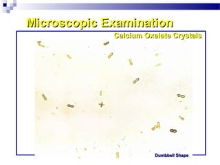 Microscopic ExaminationMicroscopic Examination
Calcium Oxalate CrystalsCalcium Oxalate Crystals
Dumbbell ShapeDumbbell Shape
 