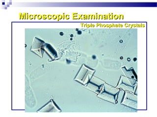 Microscopic ExaminationMicroscopic Examination
Triple Phosphate CrystalsTriple Phosphate Crystals
 