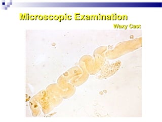 Microscopic ExaminationMicroscopic Examination
Waxy CastWaxy Cast
 