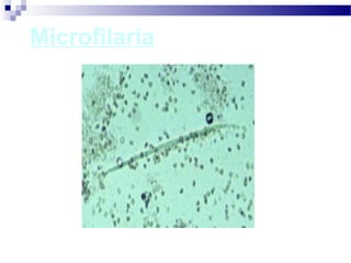 Microfilaria
 