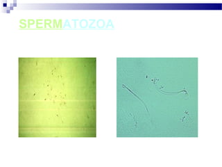 SPERMATOZOA
 