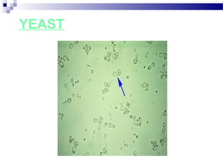 YEAST
 