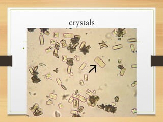 crystals
•
 