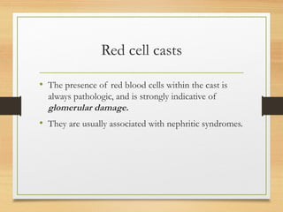 Red cell casts
• The presence of red blood cells within the cast is
always pathologic, and is strongly indicative of
glomerular damage.
• They are usually associated with nephritic syndromes.
 