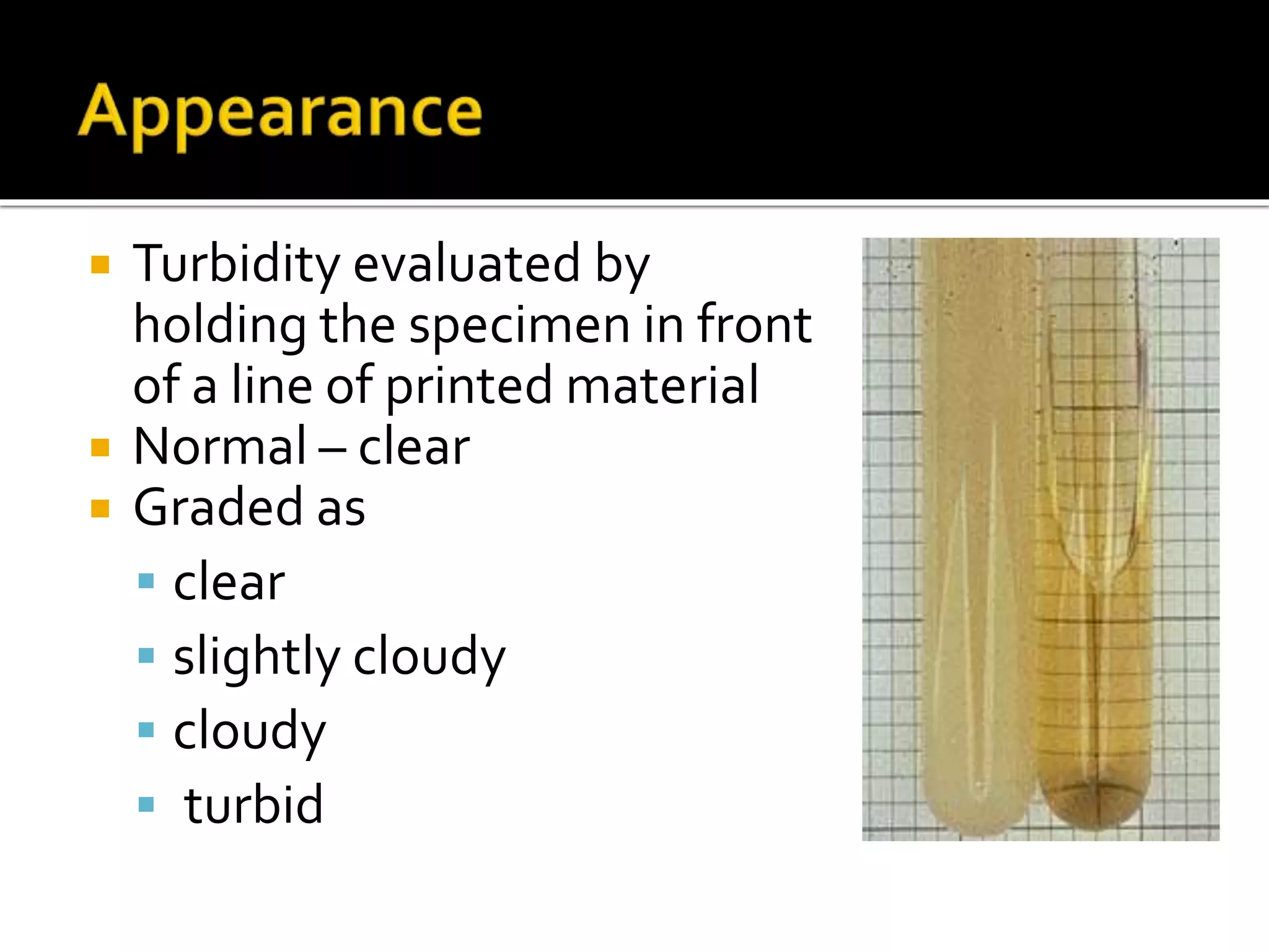  Turbidity evaluated by
holding the specimen in front
of a line of printed material
 Normal – clear
 Graded as
 clear
 slightly cloudy
 cloudy
 turbid
 