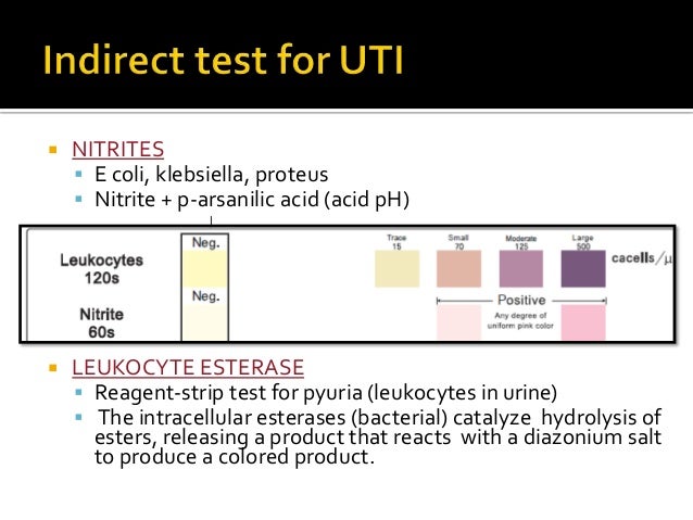 500 Leukocytes In Urine / What do Urinary Leukocytes Indicate? (with
