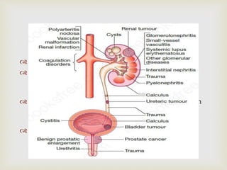 
 Blood
 Presence of blood in the urine is known as
hematuria. In dipstick test, heme is detected by
chromogen strip.
 Positive dipstick for heme may result not only from
urinary RBCs but also from hemoglobin or free
myoglobin.
 Causes of hematuria
 