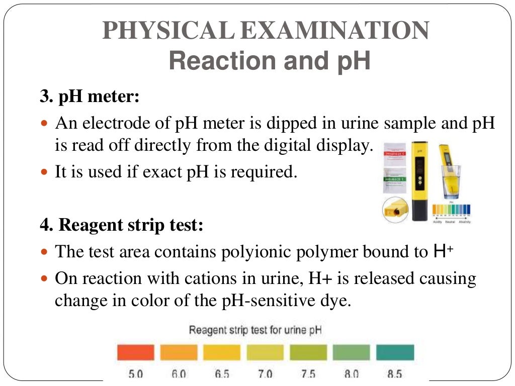 Urine analysis