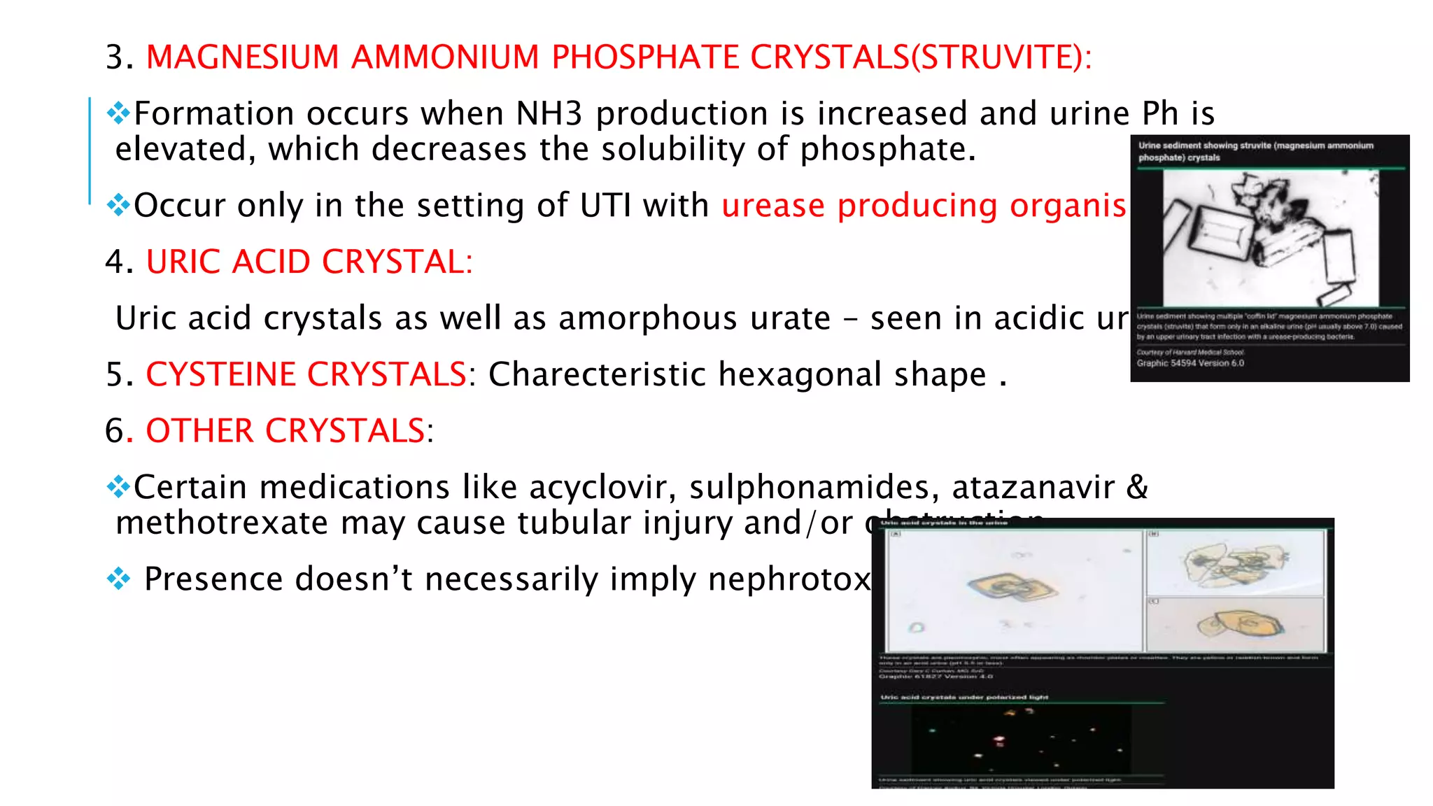 Urine analysis | PPTX