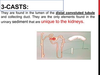 3-CASTS:
They are found in the lumen of the distal convoluted tubule
and collecting duct. They are the only elements found in the
urinary sediment that are unique to the kidneys.
 
