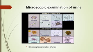 Microscopic examination of urine
 Microscopic examination of urine
 