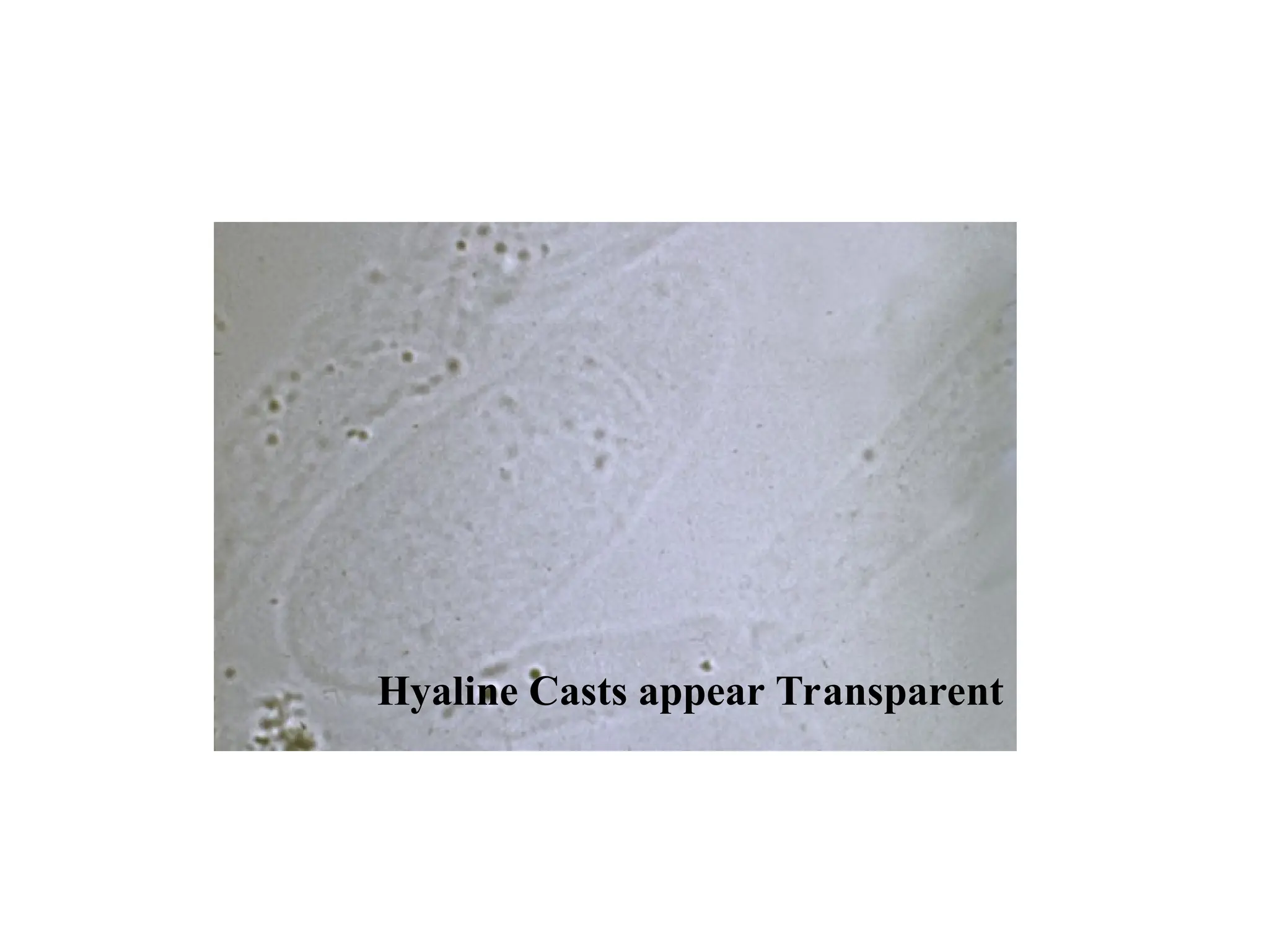 Hyaline Casts appear Transparent
 