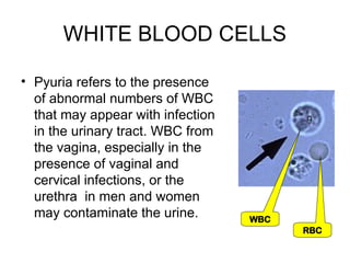 Pyuria Urine Sample Urine Analysis each criteria and values for clinical setting | PPT