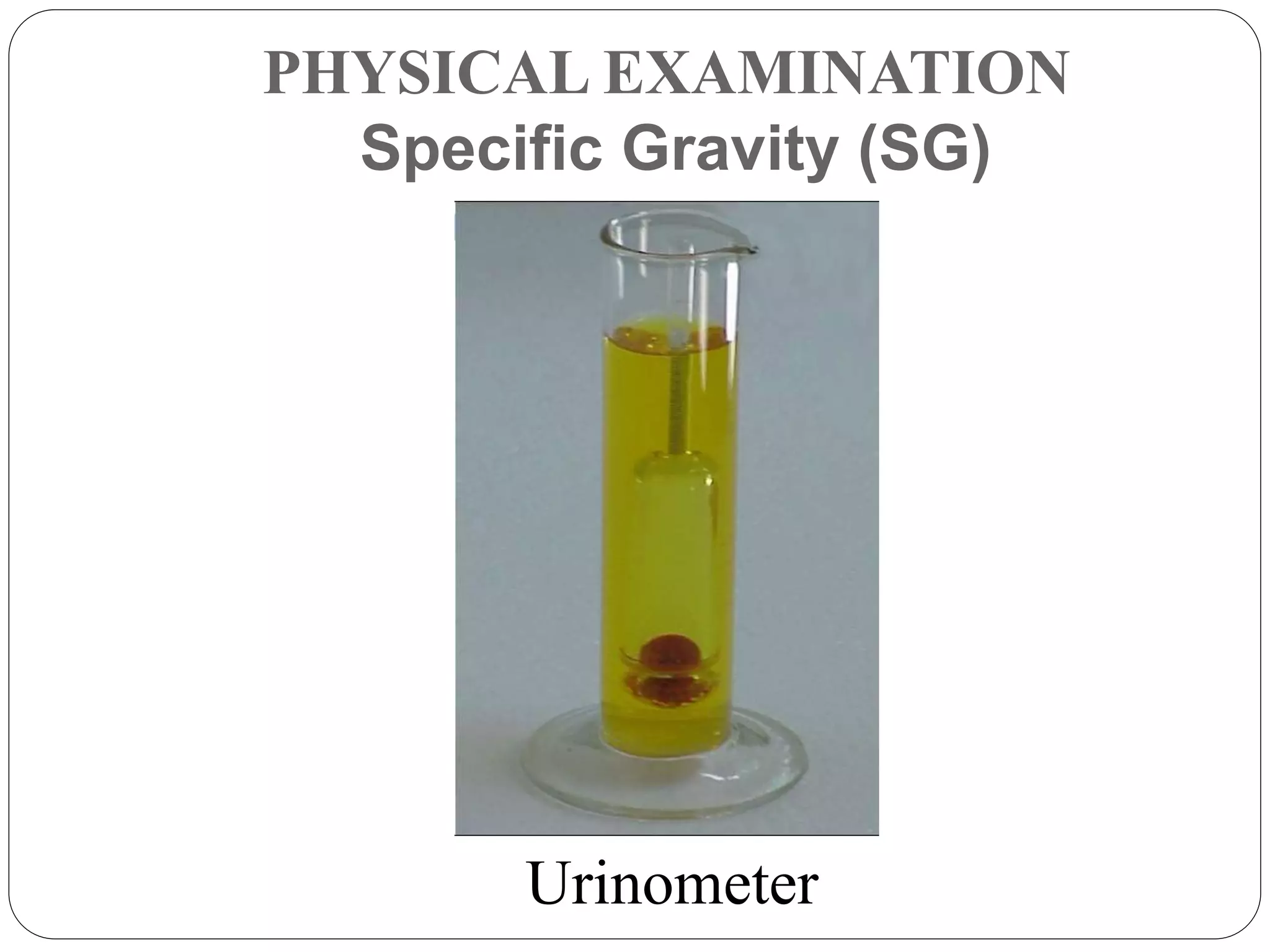PHYSICAL EXAMINATION
Specific Gravity (SG)
Urinometer
 
