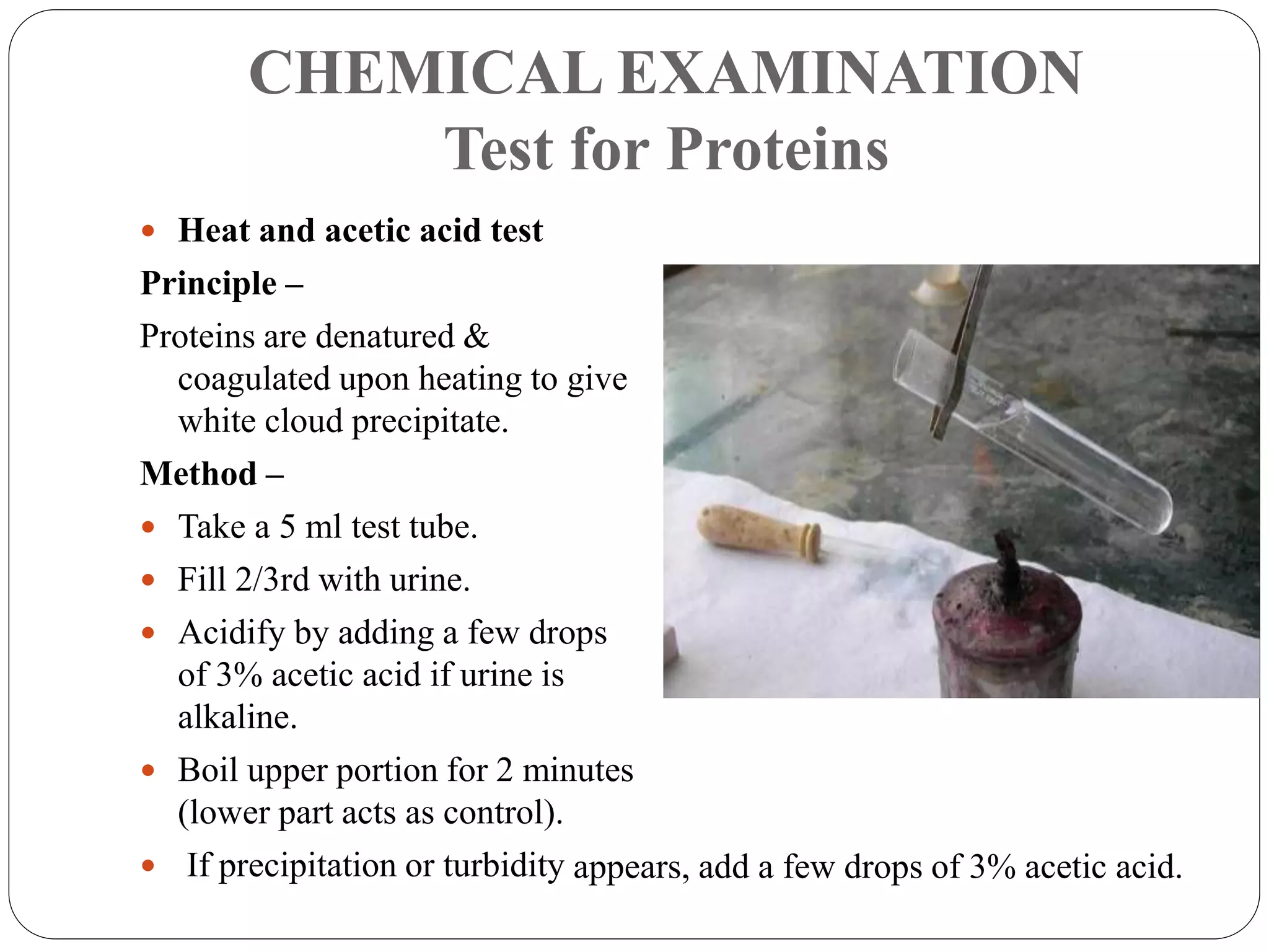 CHEMICAL EXAMINATION
Test for Proteins
 Heat and acetic acid test
Principle –
Proteins are denatured &
coagulated upon heating to give
white cloud precipitate.
Method –
 Take a 5 ml test tube.
 Fill 2/3rd with urine.
 Acidify by adding a few drops
of 3% acetic acid if urine is
alkaline.
 Boil upper portion for 2 minutes
(lower part acts as control).
 If precipitation or turbidity appears, add a few drops of 3% acetic acid.
 