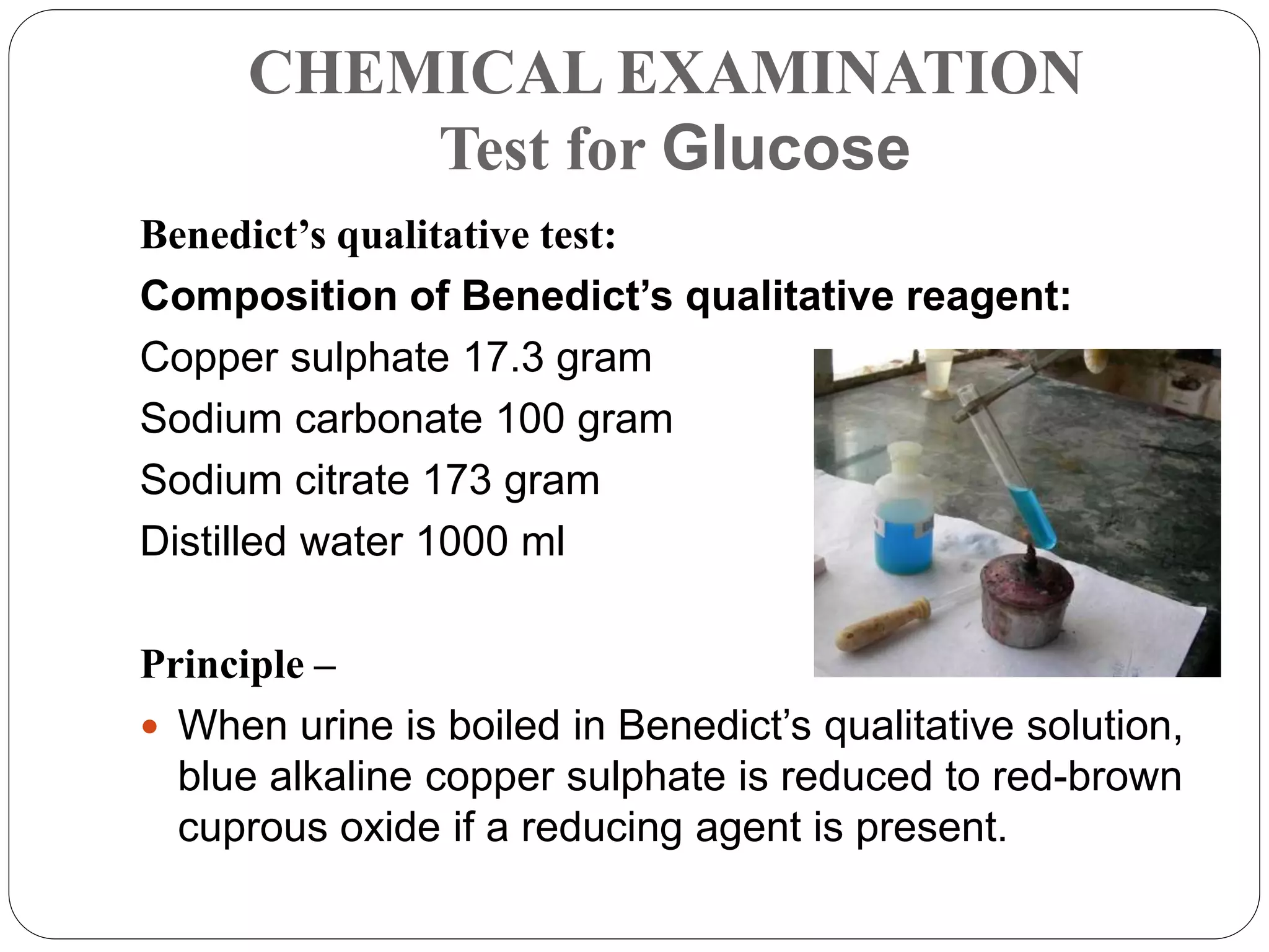 CHEMICAL EXAMINATION
Test for Glucose
Benedict’s qualitative test:
Composition of Benedict’s qualitative reagent:
Copper sulphate 17.3 gram
Sodium carbonate 100 gram
Sodium citrate 173 gram
Distilled water 1000 ml
Principle –
 When urine is boiled in Benedict’s qualitative solution,
blue alkaline copper sulphate is reduced to red-brown
cuprous oxide if a reducing agent is present.
 